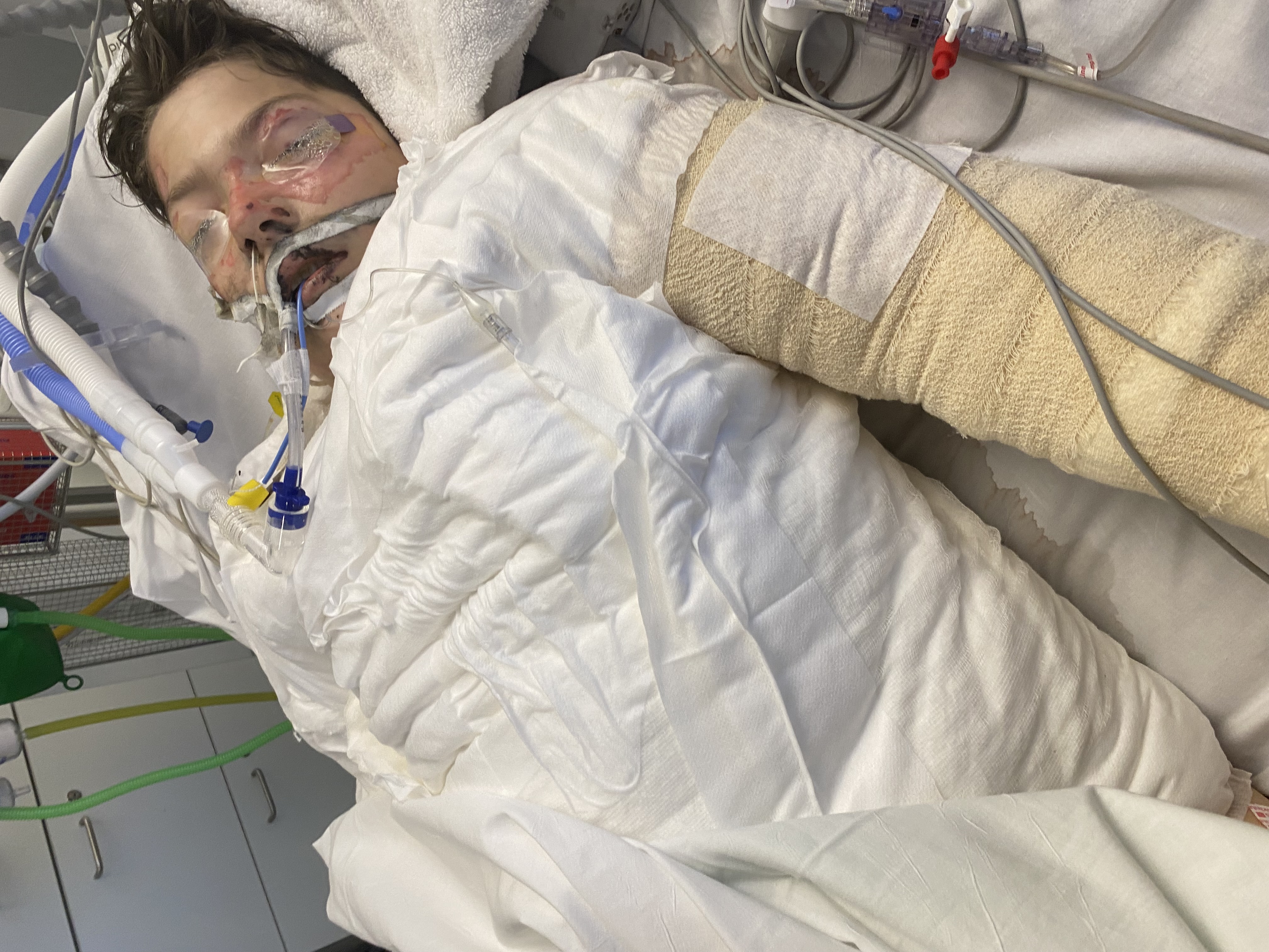 Blaine in hospital 